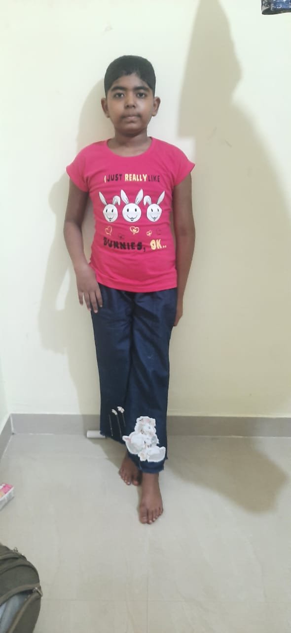 Ms Shubhshree After Treatment