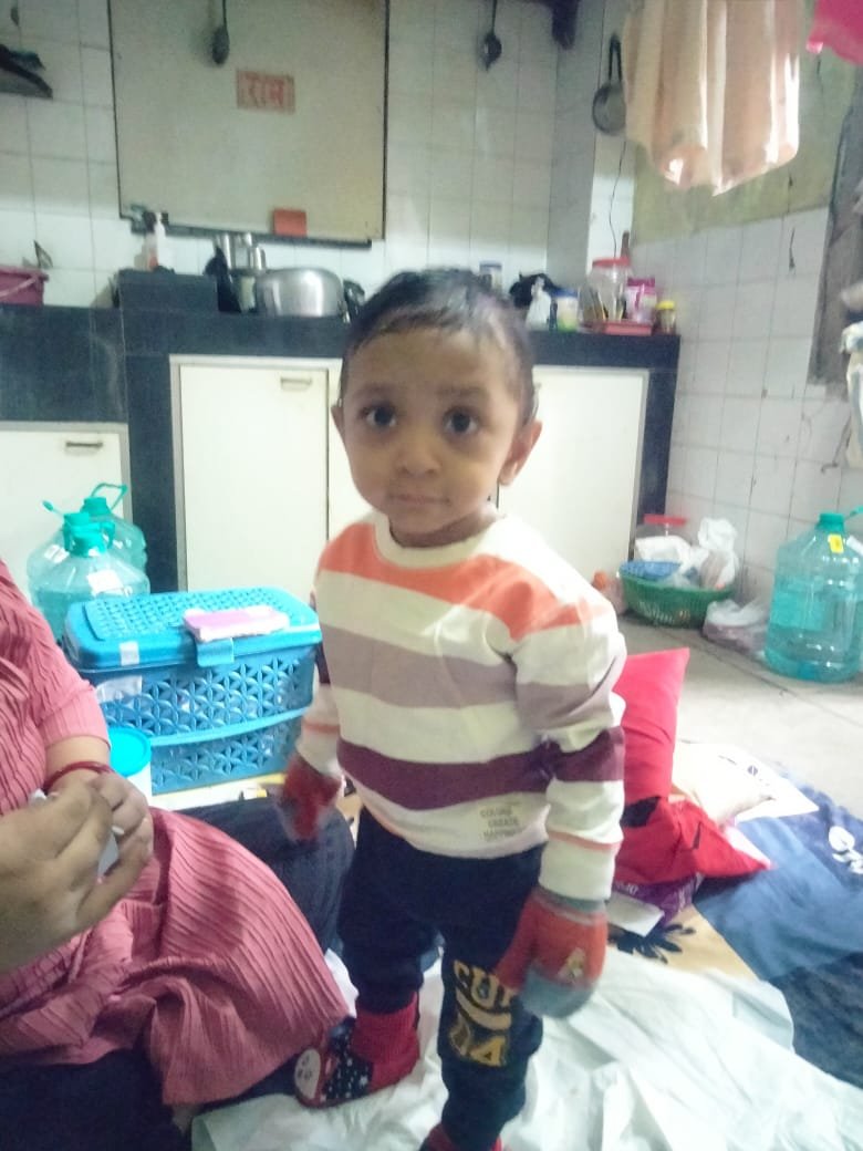 Omansh Pandya After Treatment